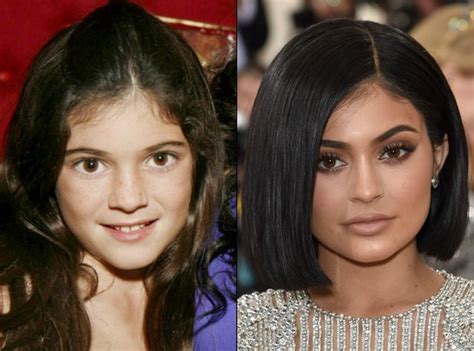 Kylie Jenners Transformation Gallery: See Before